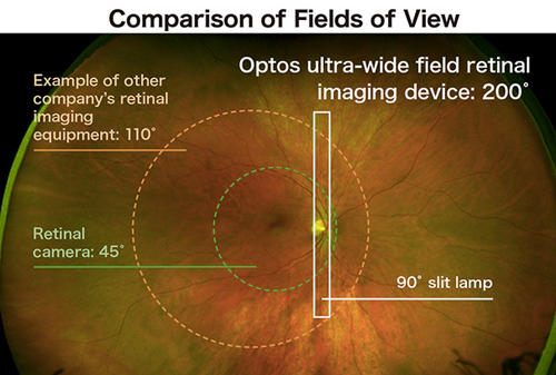 comparison-field-of-views